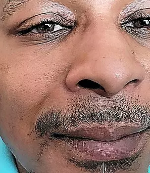 Alphonso Layz