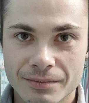 Artie
