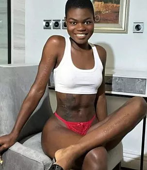 Daisy_melanin