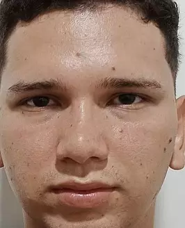 Erick
