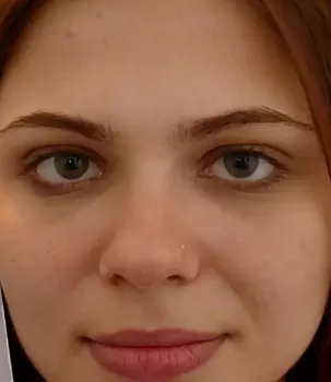 Erika Korti
