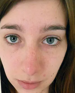 Mishka Devlin