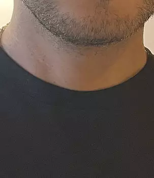 Cuckoldycorneador