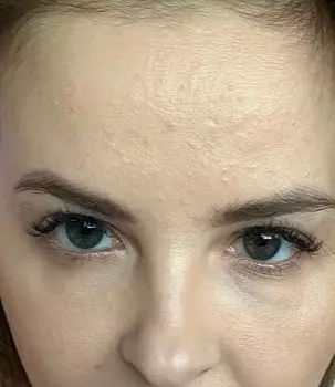 Candy Alexa