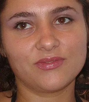 Ionella