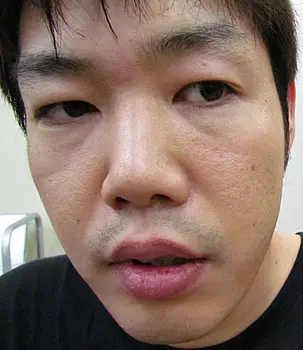 You