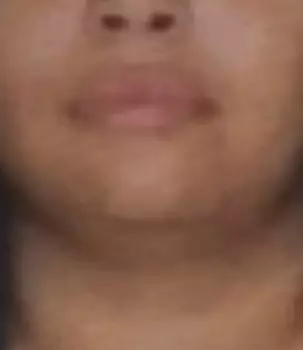 Chubby Big Busty