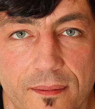 Dieter Von Stein