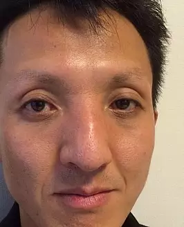 Teipei