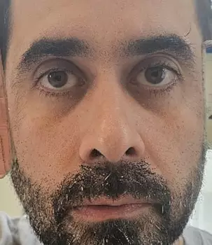 Billy thedick