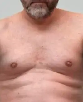 Tom Coiote