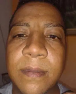 Lima Indaiatuba