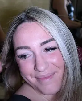 Anita acerba