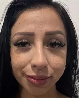 Malexxa