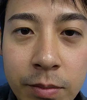 Atsushi Suzuki