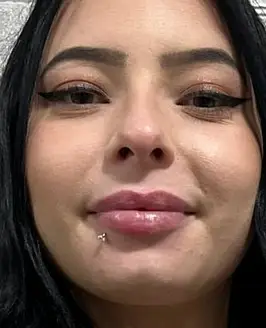 Kalyca