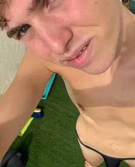 Fimosis Twinky