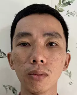 NguyenVanTuan