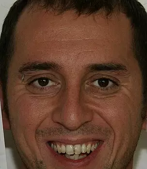 Frenky