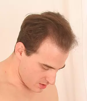 Brad Balduin
