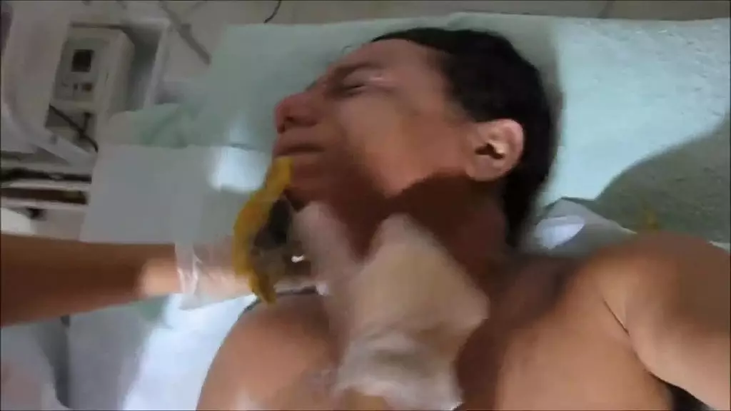 Scorching Wax Depilacao with Bluezao